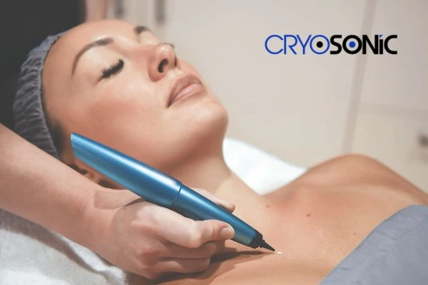 Cryosonic lesion removal prices book today! Newbury