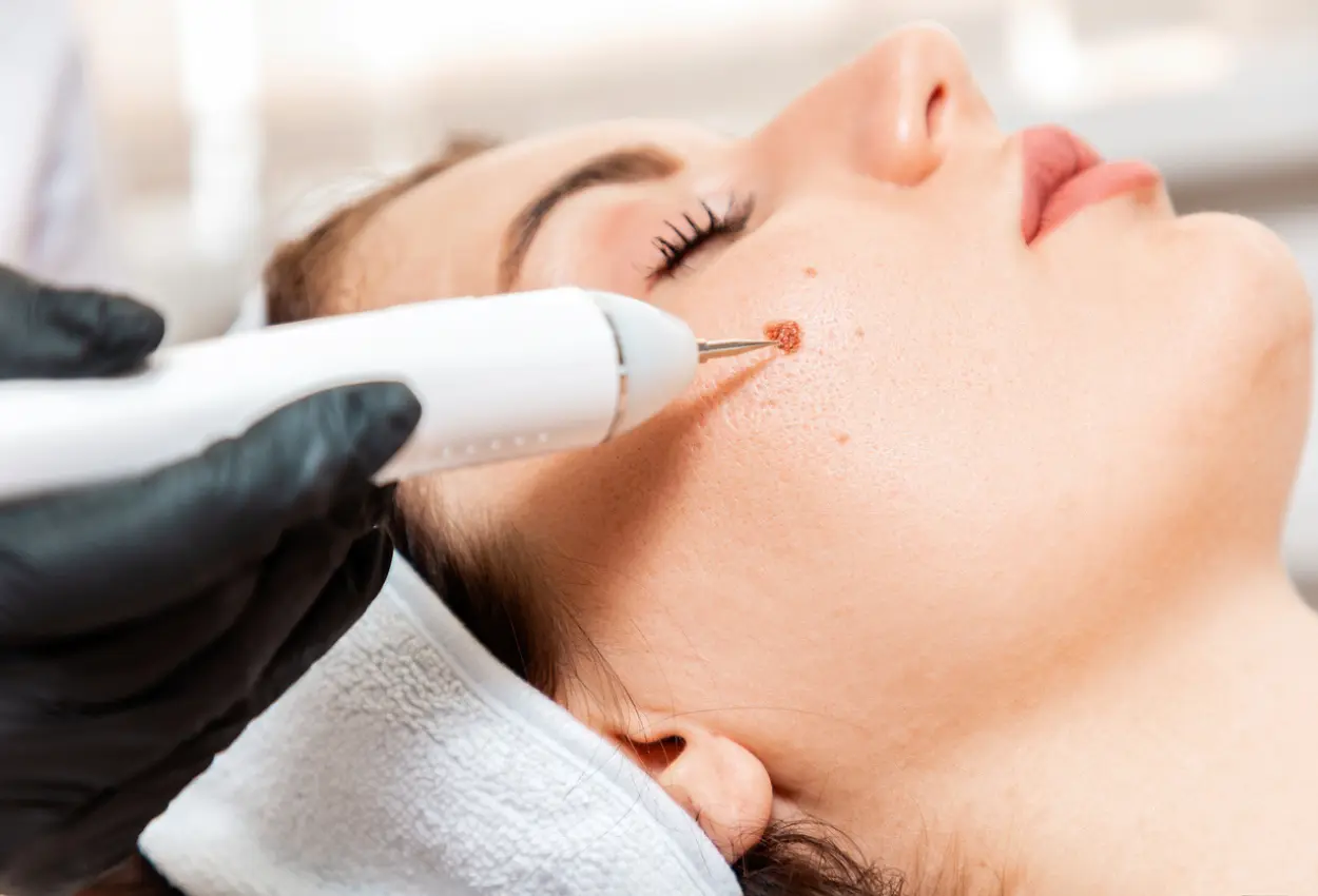 Frequently Asked Questions About Multiple Cryotherapy Treatments Newbury