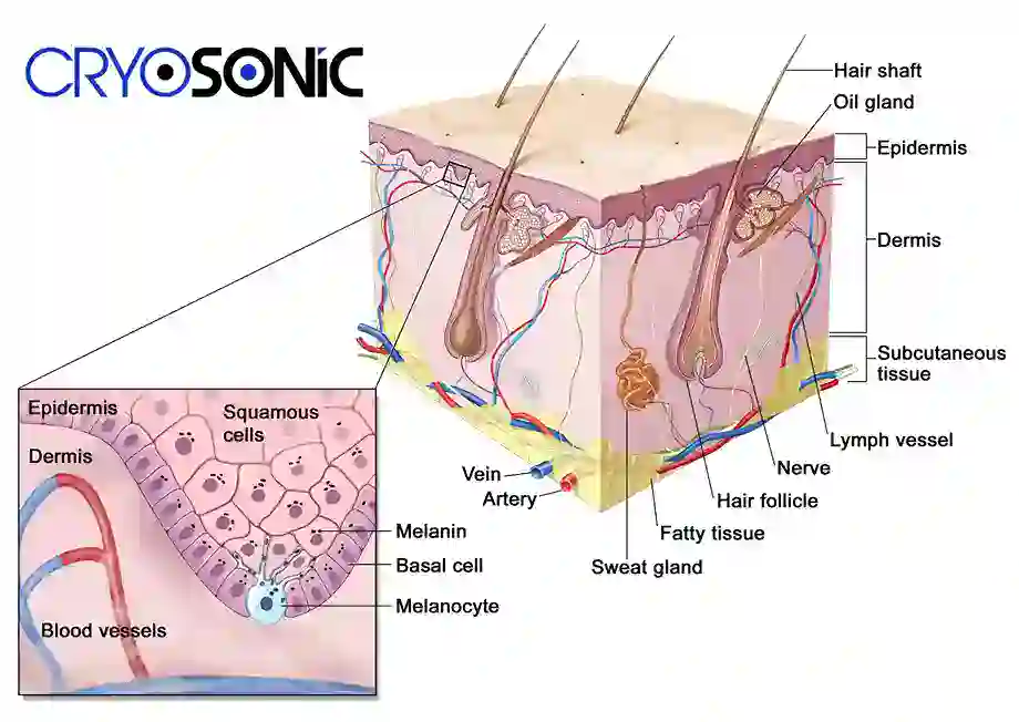 How Cryotherapy Stimulates Melanocyte Activity Newbury